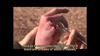 映画|ザ・マッドネス 狂乱の森|Kalevet (Rabies) (49) 画像
